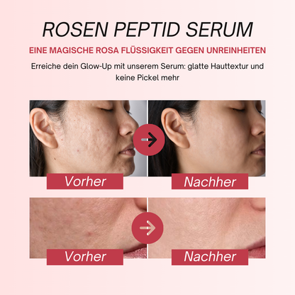 Rosen-Peptid-Serum mit PDRN