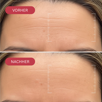 BIO-KOLLAGEN-WRAPPING MASKE + PINSEL