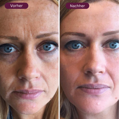 VITALY Kollagen-Lifting-Stick