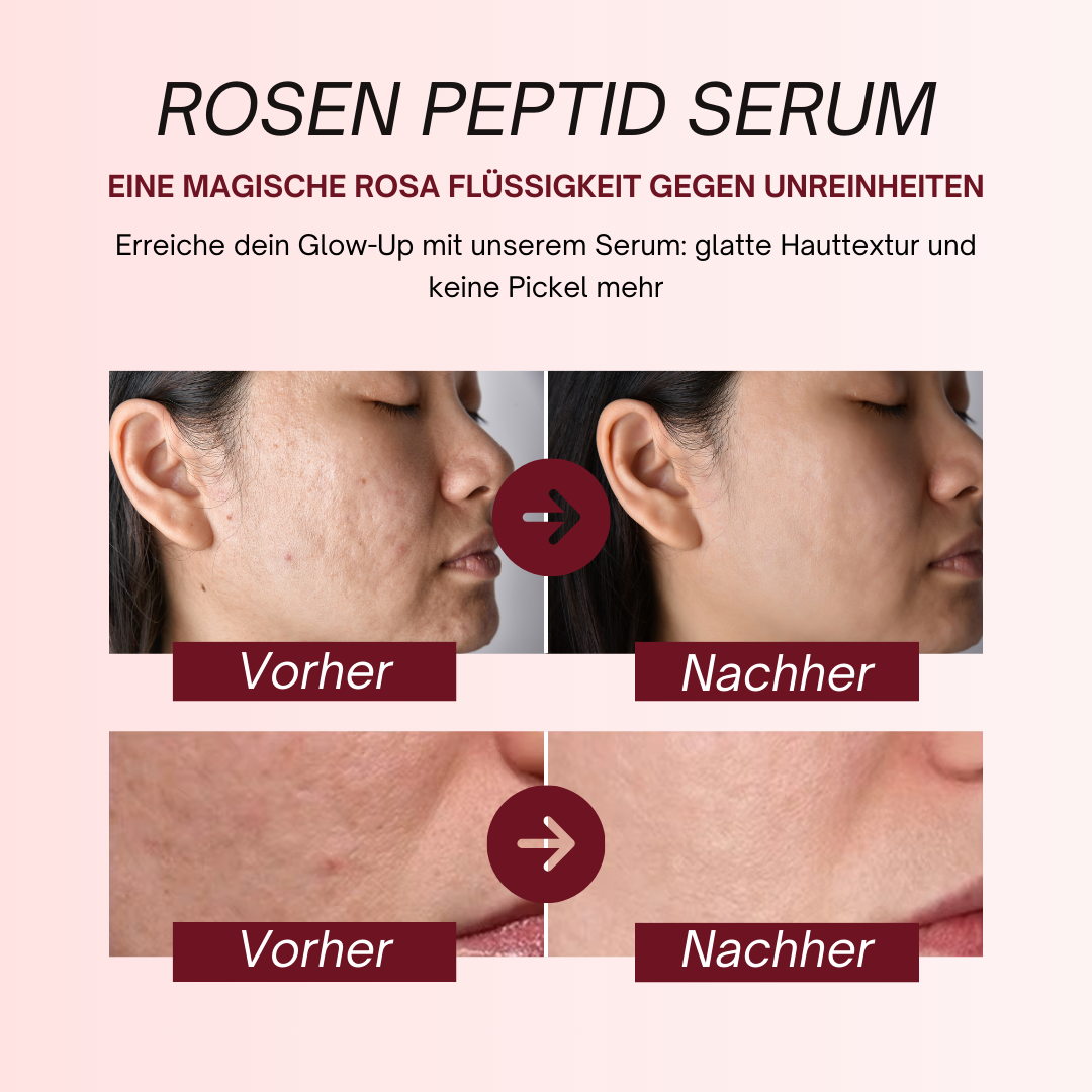 PDRN Rosen-Peptid-Serum