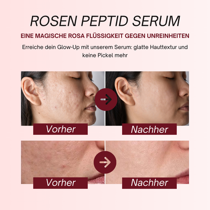 PDRN Rosen-Peptid-Serum